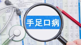 14週連続で増加｢手足口病｣で知っておきたいこと